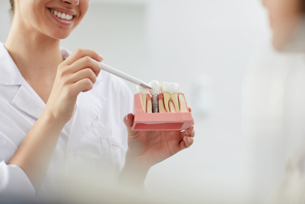 Dental Implants in Flower Mound, Texas