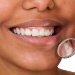 Root Canals and Tooth Sensitivity
